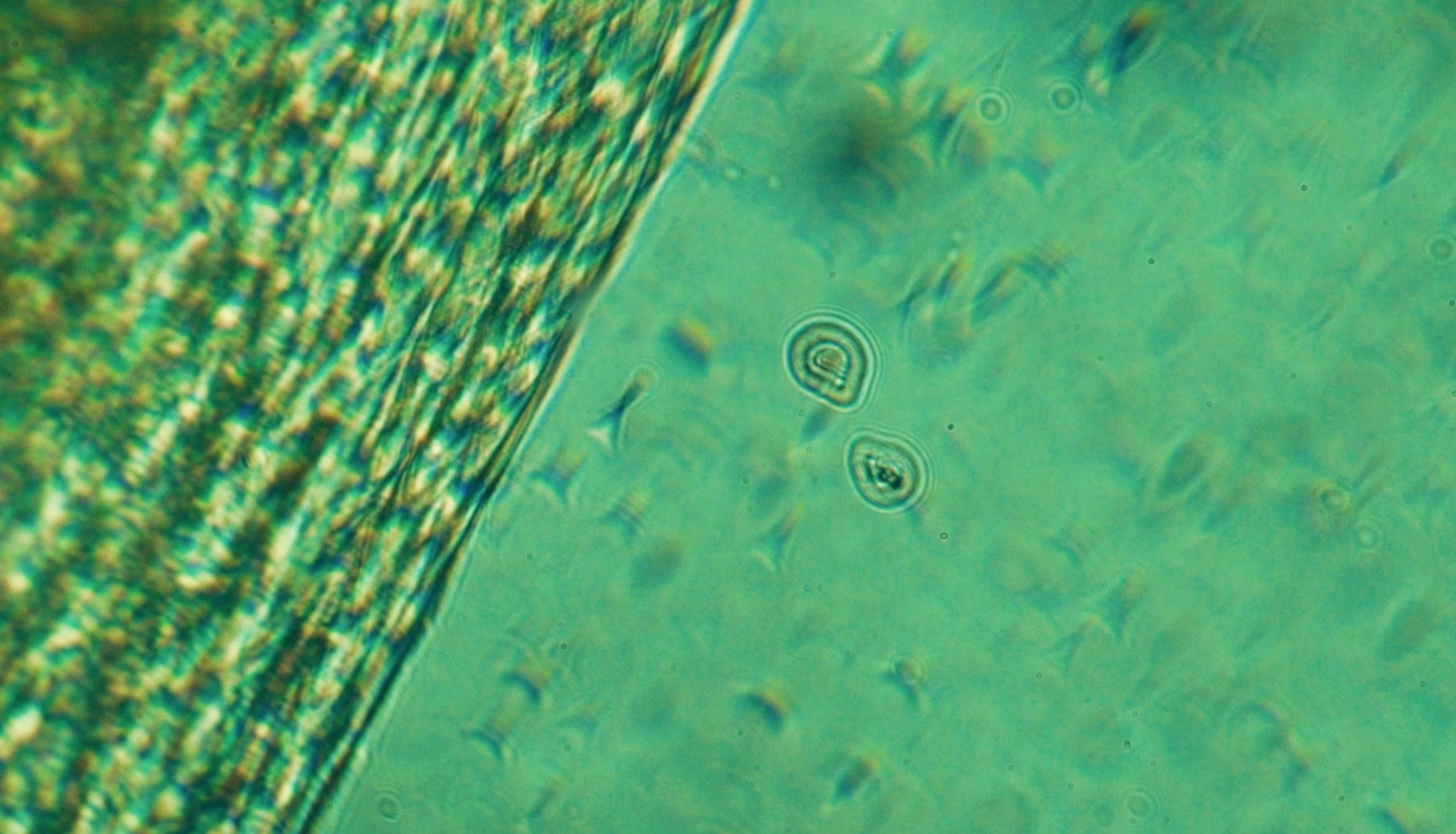 How To Detox From Microplastics (Without Losing Your Mind)